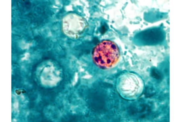 Is Cyclospora Coming For You?
