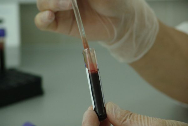 News Roundup: MD Anderson Cancer Researcher Awarded Nobel Prize