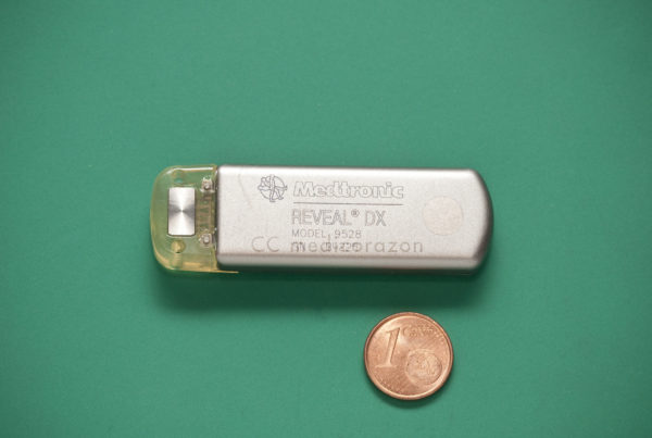 How Medical Implants Recalled In The U.S. End Up In Mexican Patients