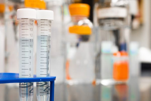 Money Donated For Rape Kit Testing Is ‘Impetus’ For A Long-Term Solution