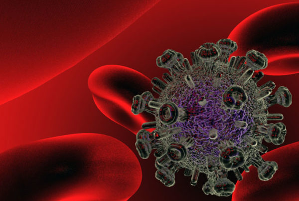 Houston Doctor Says HIV Rates Are Up In The South Often For Non-Medical Reasons