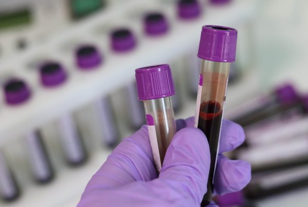 For Young Texans, Race Is A Stronger Predictor Of Cancer Survival Than Insurance Status
