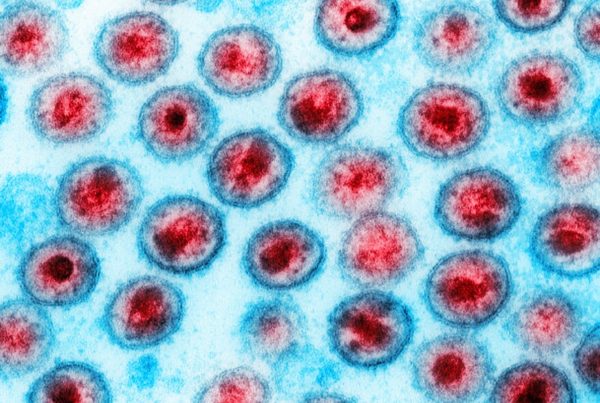 The fight against COVID may lead to an HIV vaccine in San Antonio