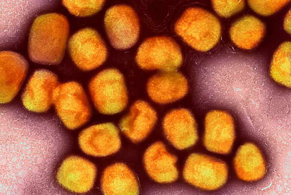As cases rise in Texas, what you need to know about monkeypox