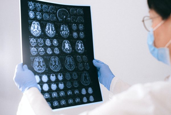 A massive federal grant will help University of North Texas researchers study Alzheimer’s