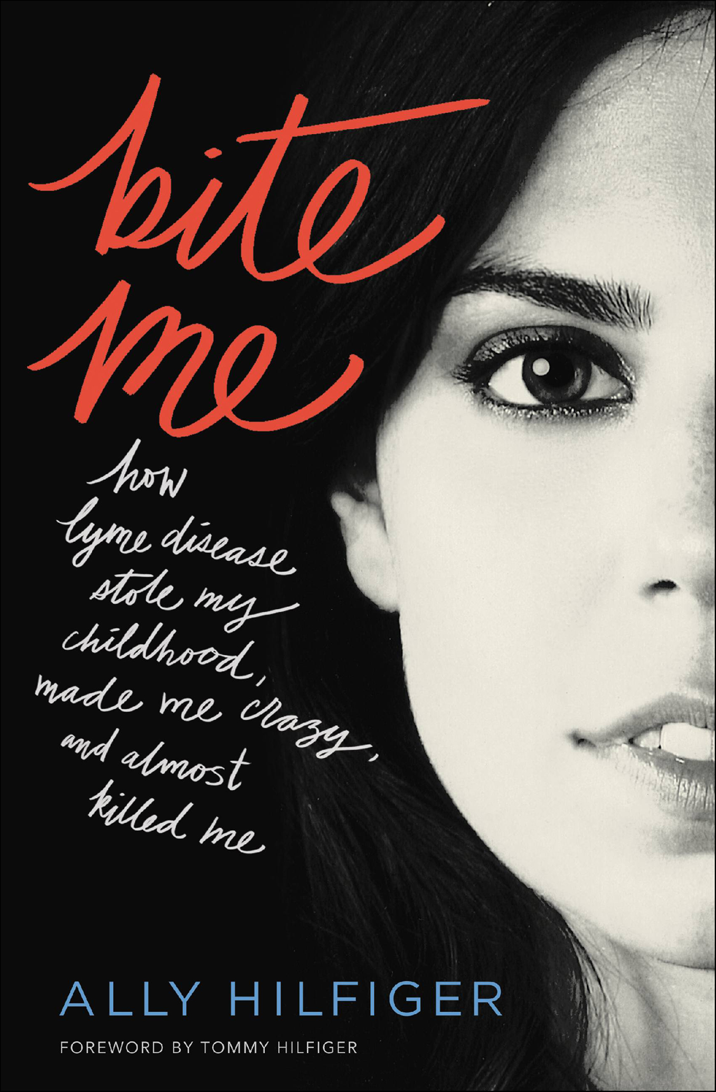This image is the cover for the book Bite Me