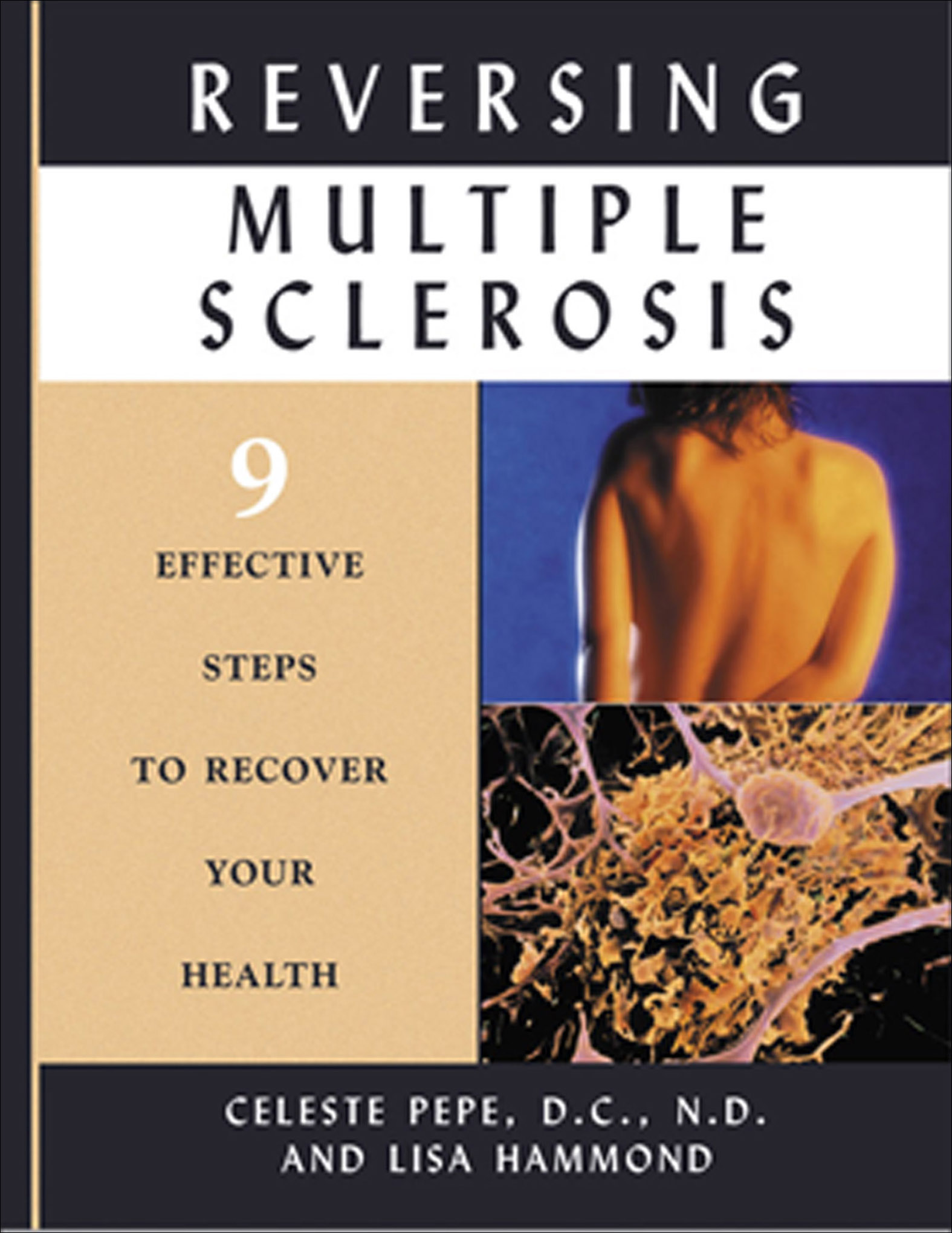 This image is the cover for the book Reversing Multiple Sclerosis