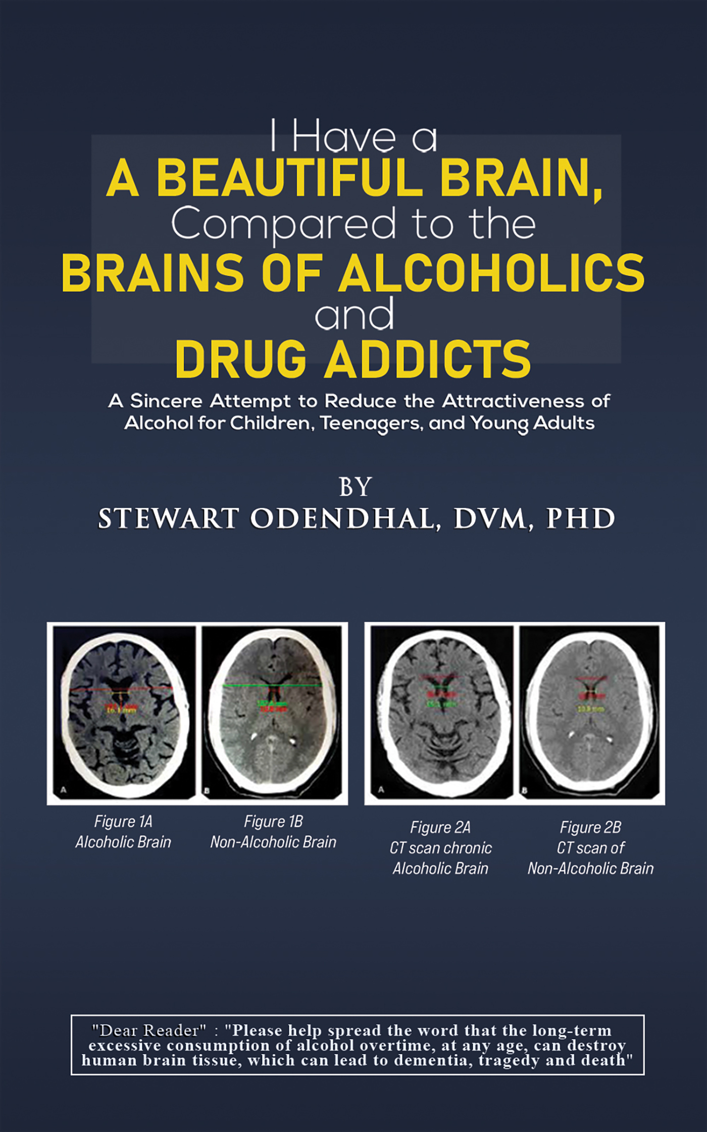 This image is the cover for the book I Have a Beautiful Brain, Compared to the Brains of Alcoholics and Drug Addicts