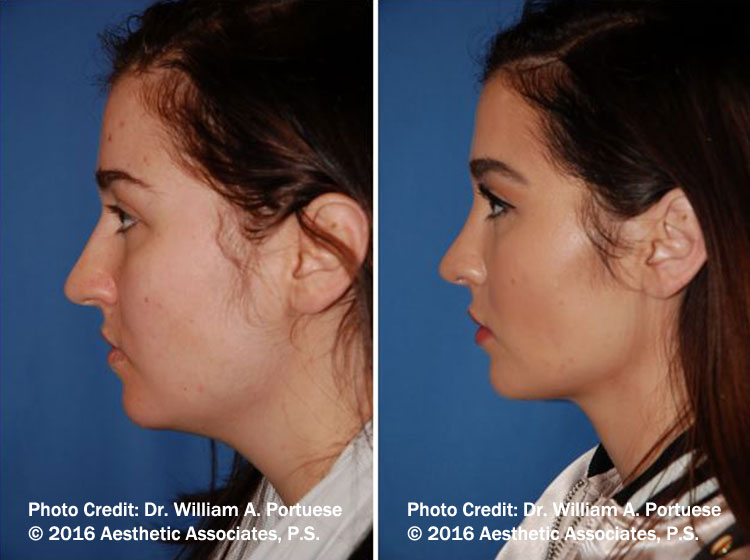 facial plastic surgery Portland Or