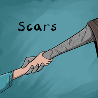 Scars
