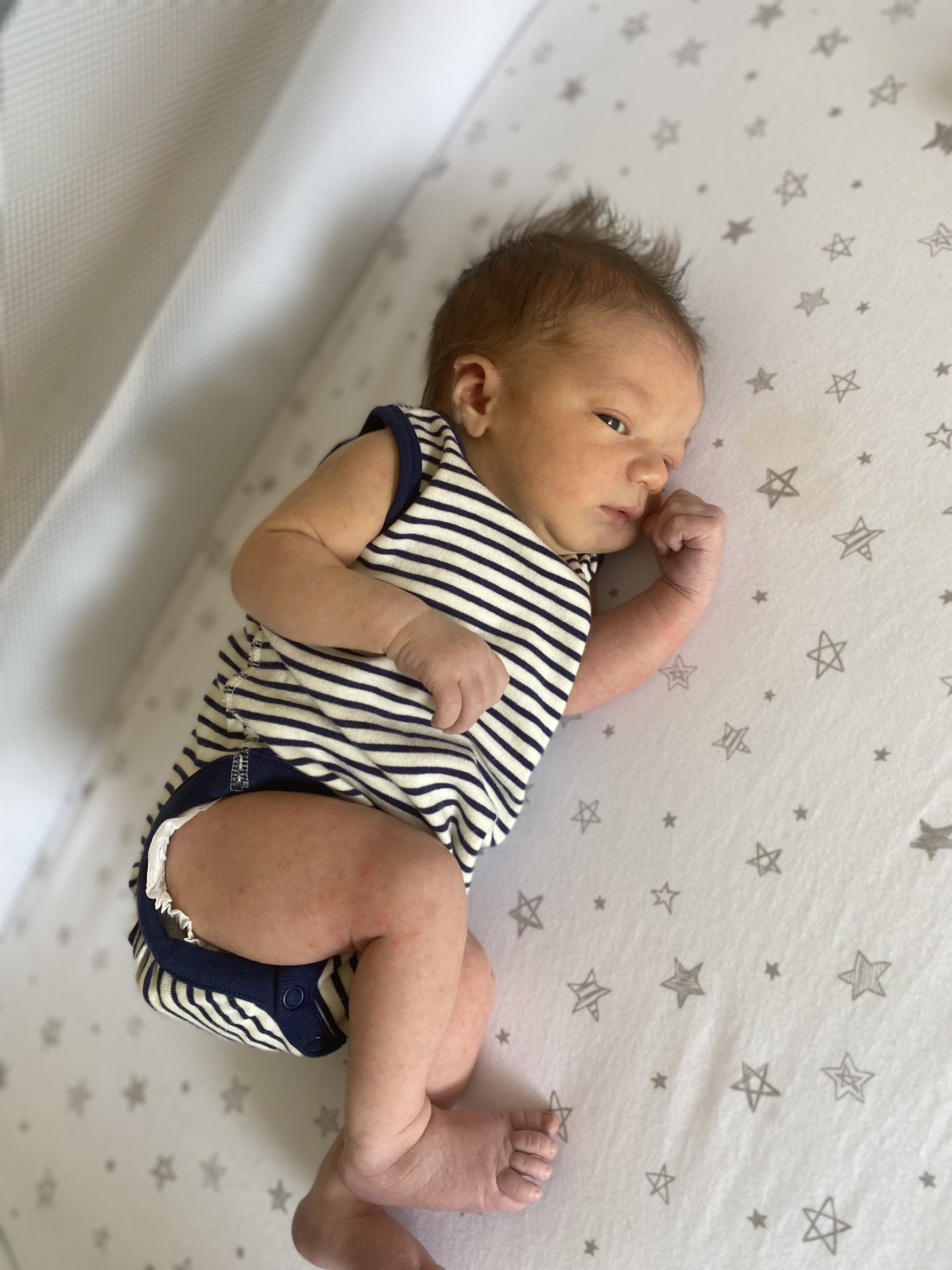 Baby with Lip and Tongue Tie