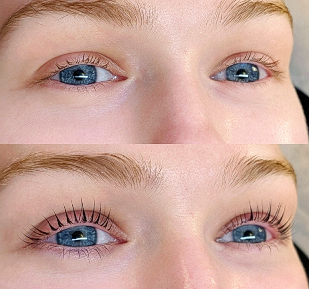 K-Lift Conversion Method by Authentik Artistry