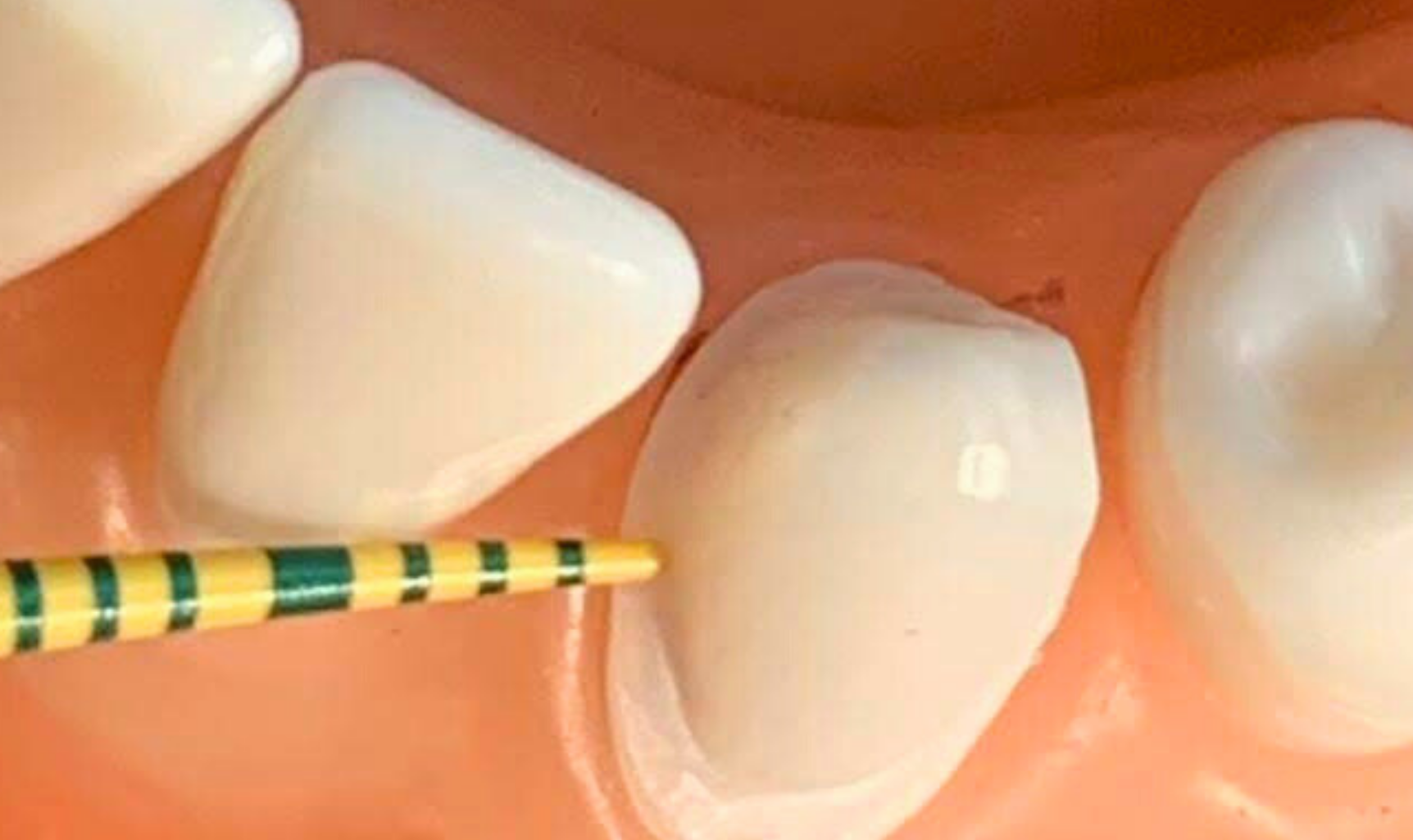 Dental Work Check For Bench Test Preparation