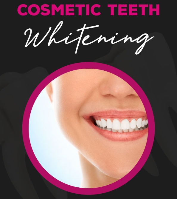 Teeth Whitening