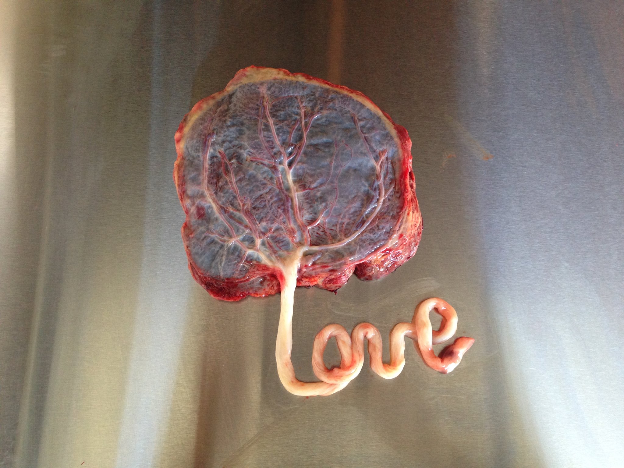 Placentophagy (Placenta Medicine)