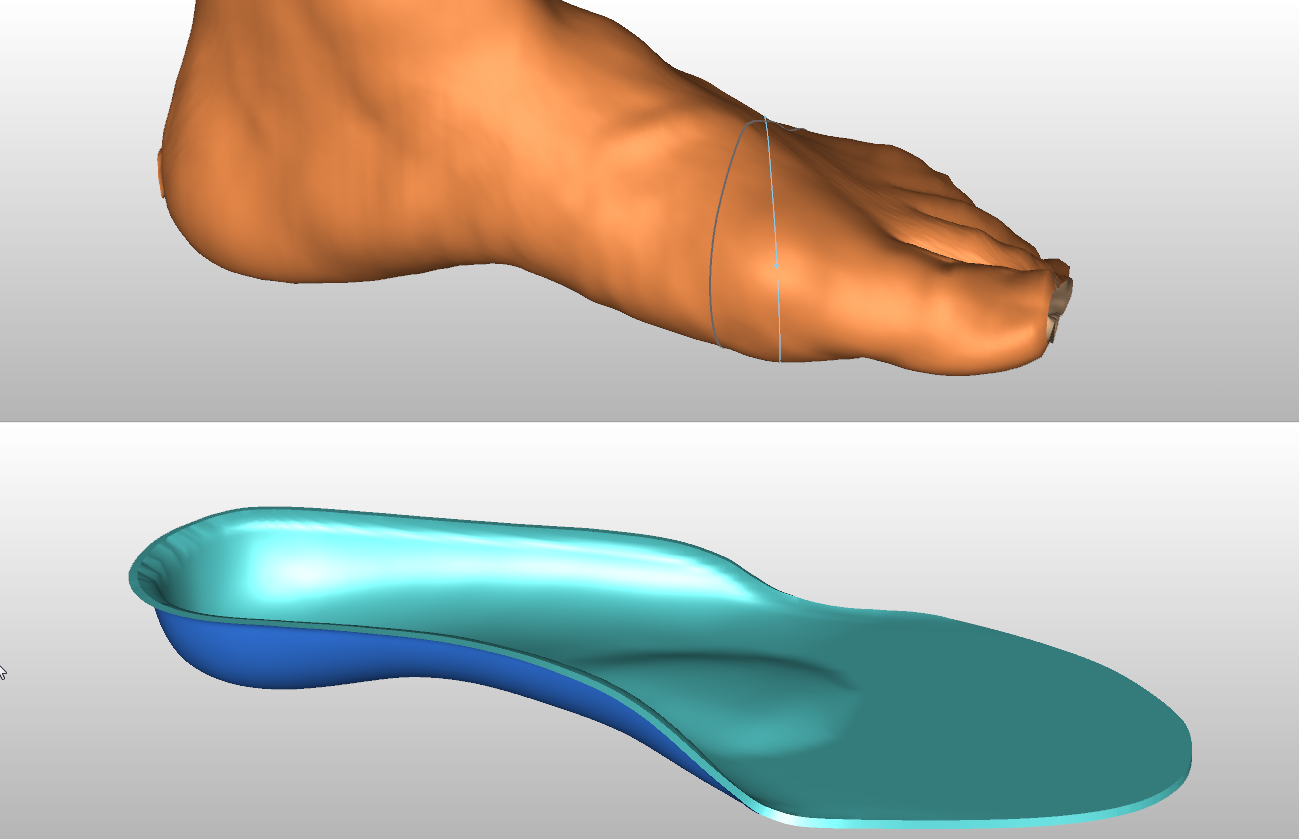 Canfit 205 Foot Orthosis Design