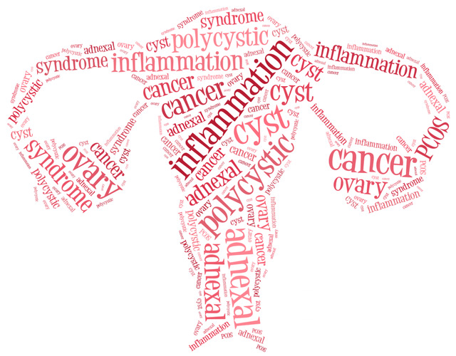 How PCOS & hormonal imbalance causes infertility- image