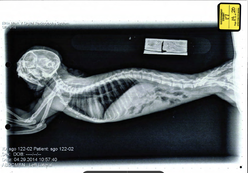 X-Ray 1