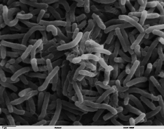 cholera