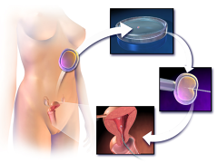 test-tube baby