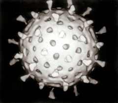 virus