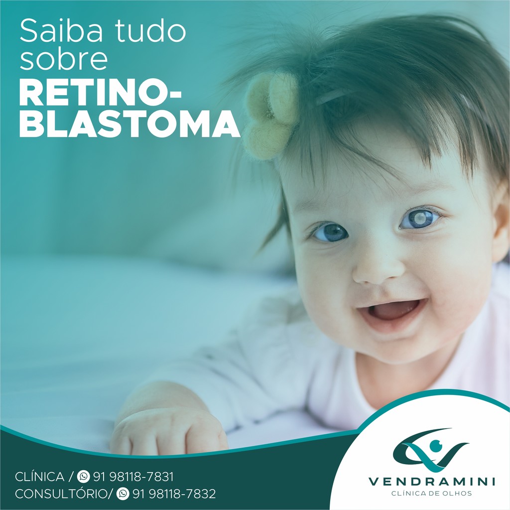 SAIBA TUDO SOBRE RETINOBLASTOMA