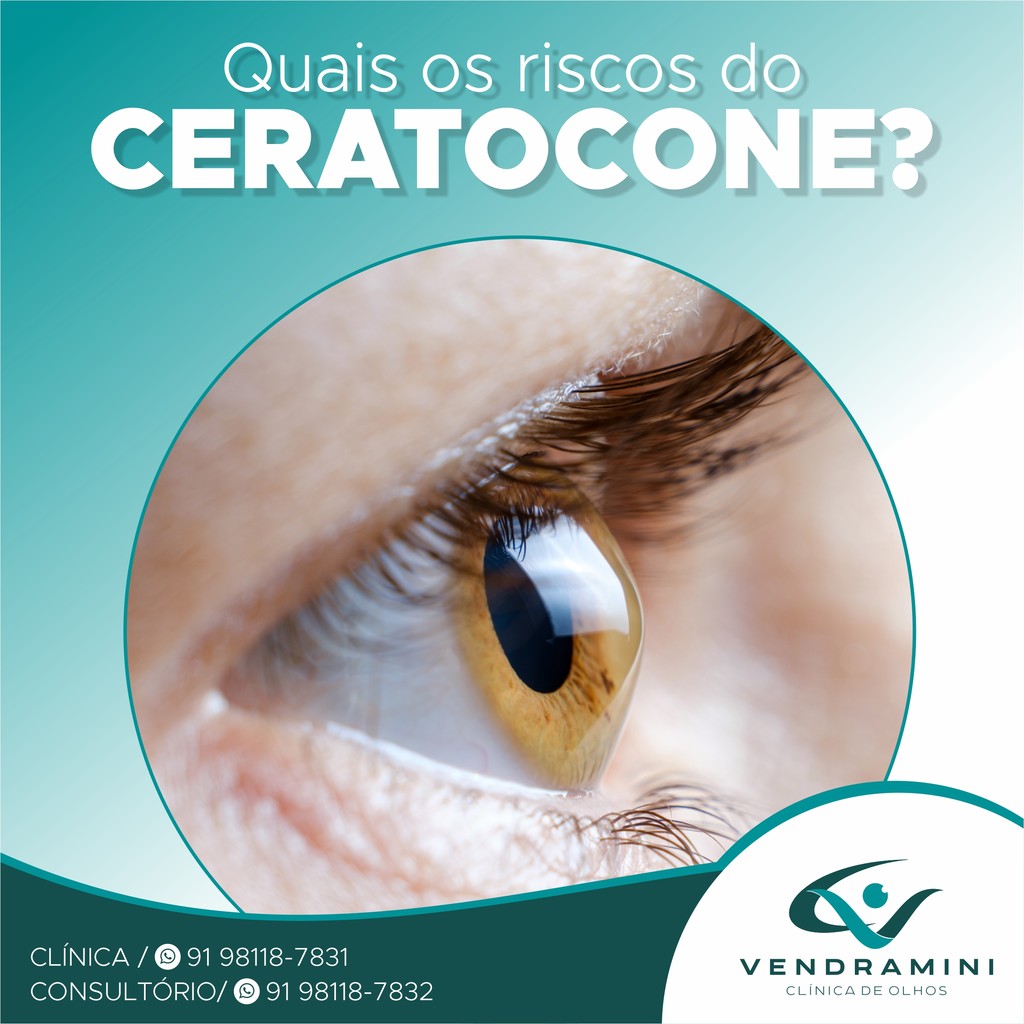 QUAIS OS RISCOS DO CERATOCONE?