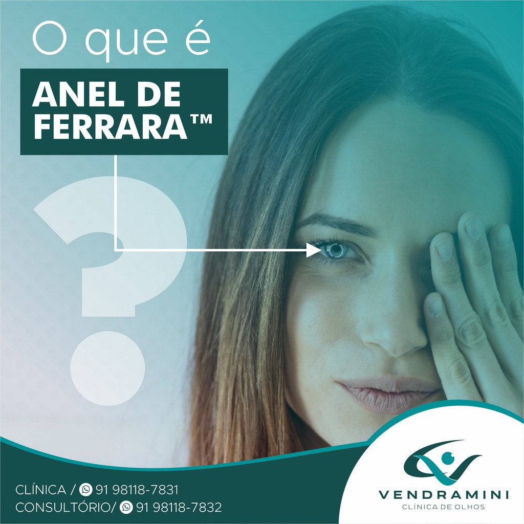 ANEL DE FERRARA
