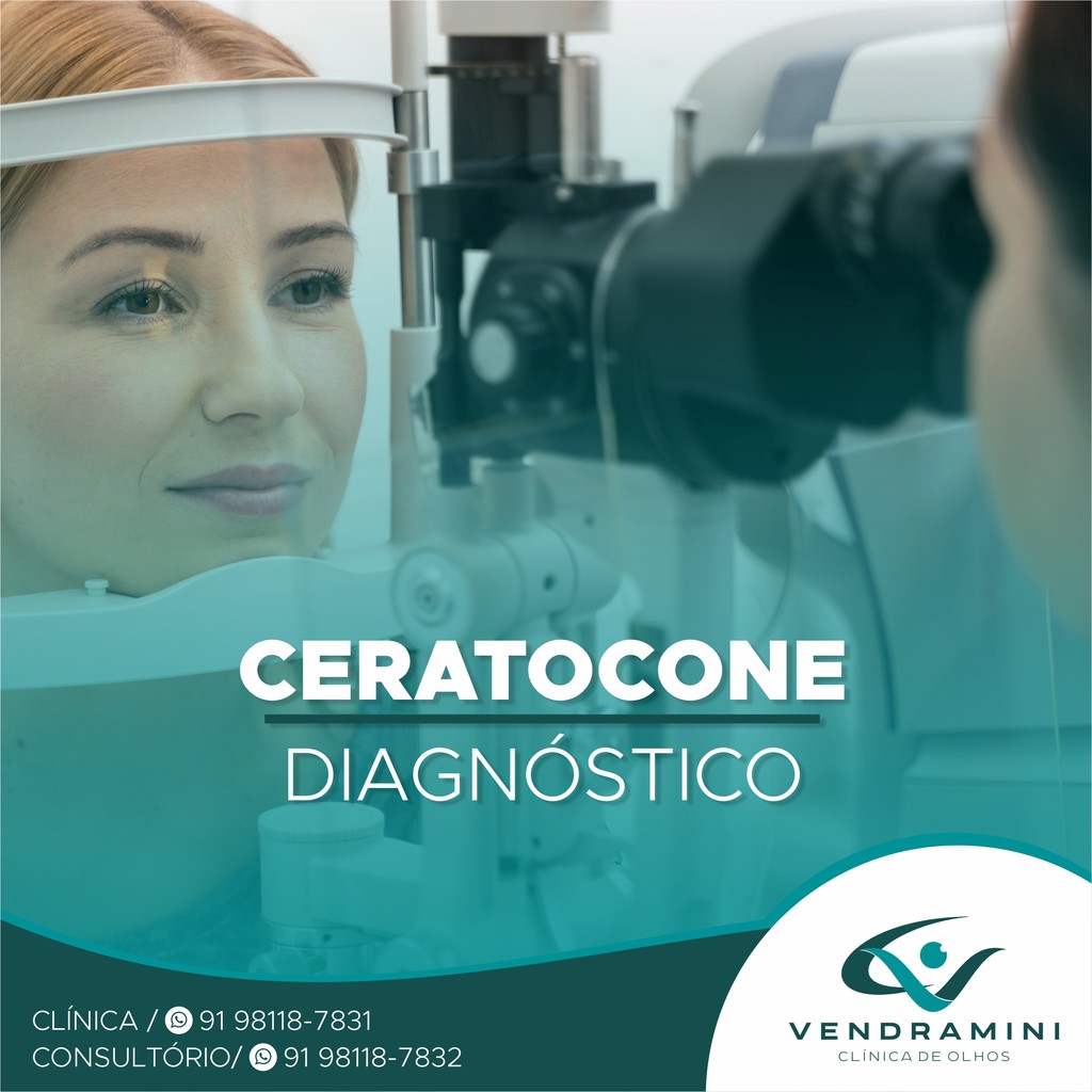 CERATOCONE - DIAGNÓSTICO