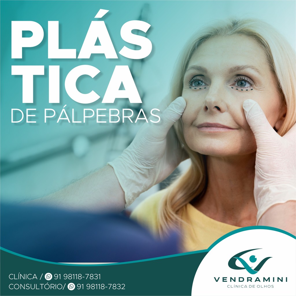 PLÁSTICA DE PÁLPEBRAS