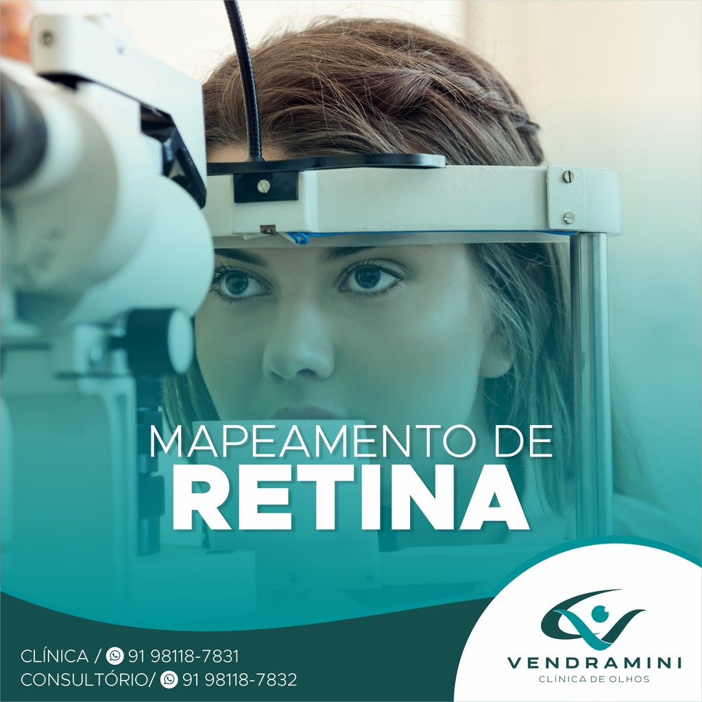 MAPEAMENTO DE RETINA