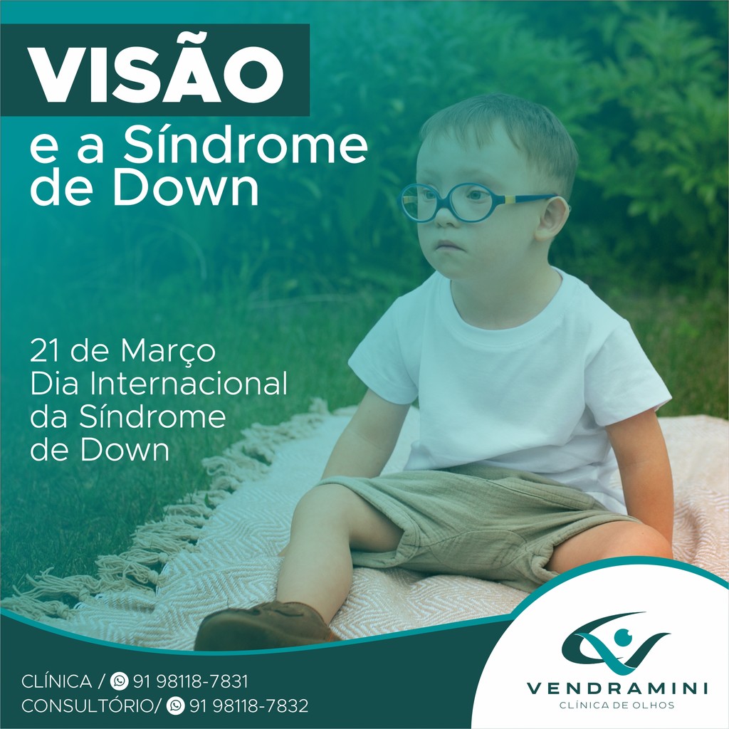 VISÃO E A SÍNDROME DE DOWN