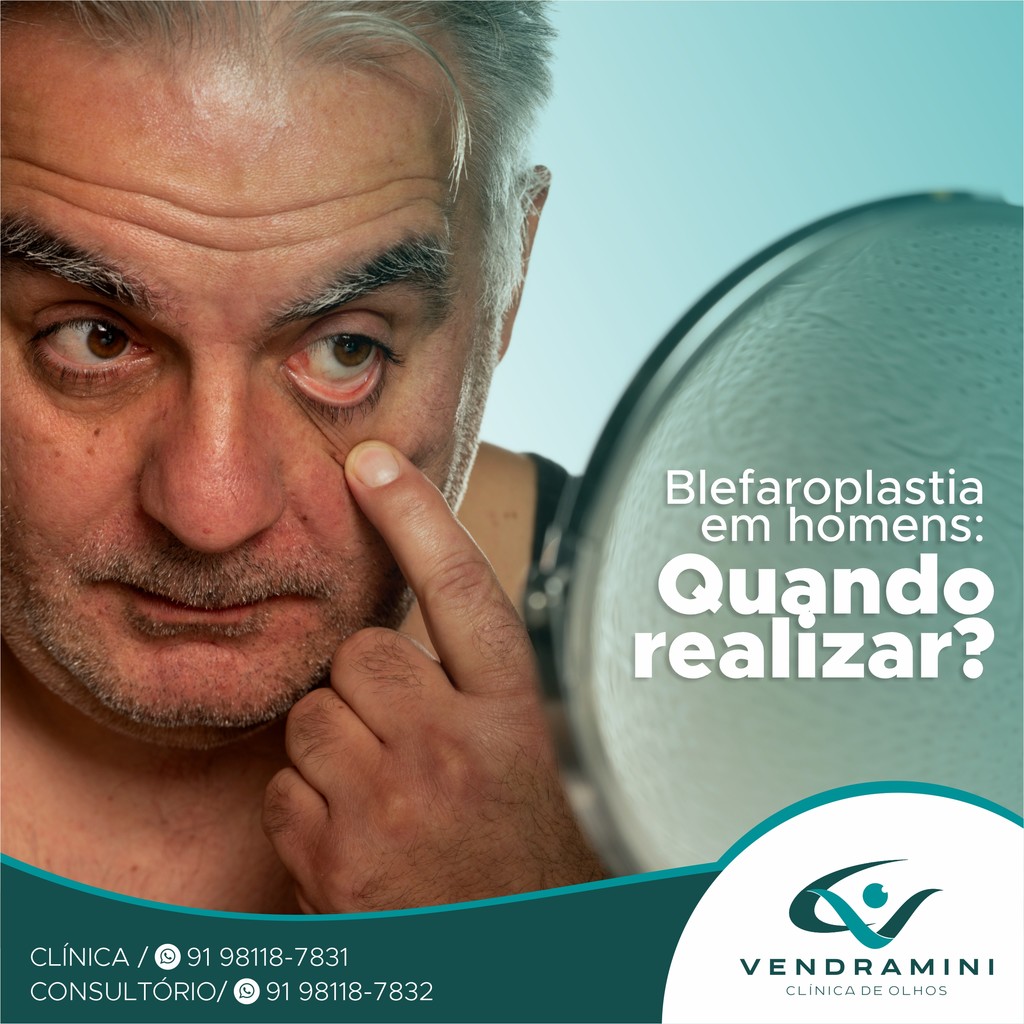 BLEFAROPLASTIA EM HOMENS- QUANDO REALIZAR?