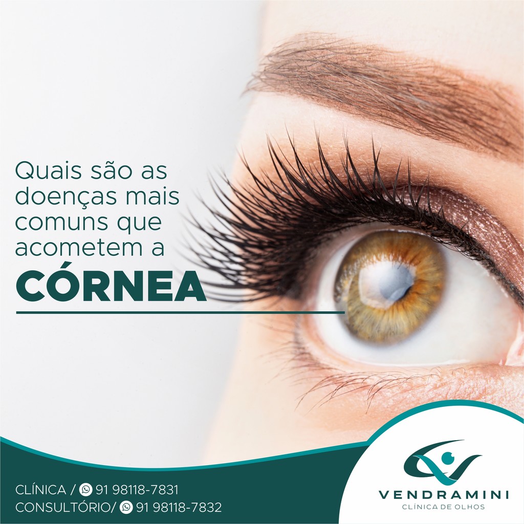 QUAIS SÃO AS DOENÇAS MAIS COMUNS QUE ACOMETEM A CÓRNEA?