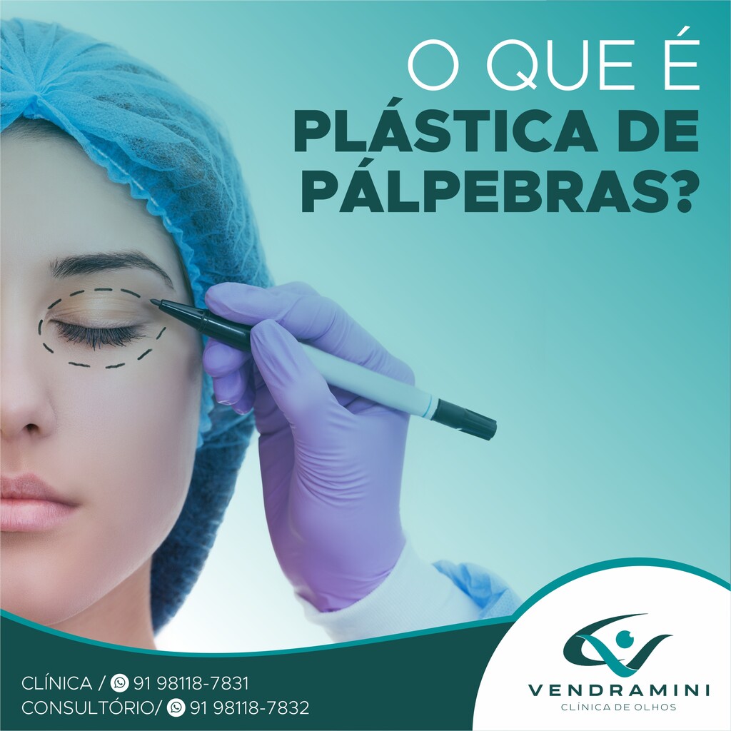 O QUE É PLÁSTICA DE PÁLPEBRAS