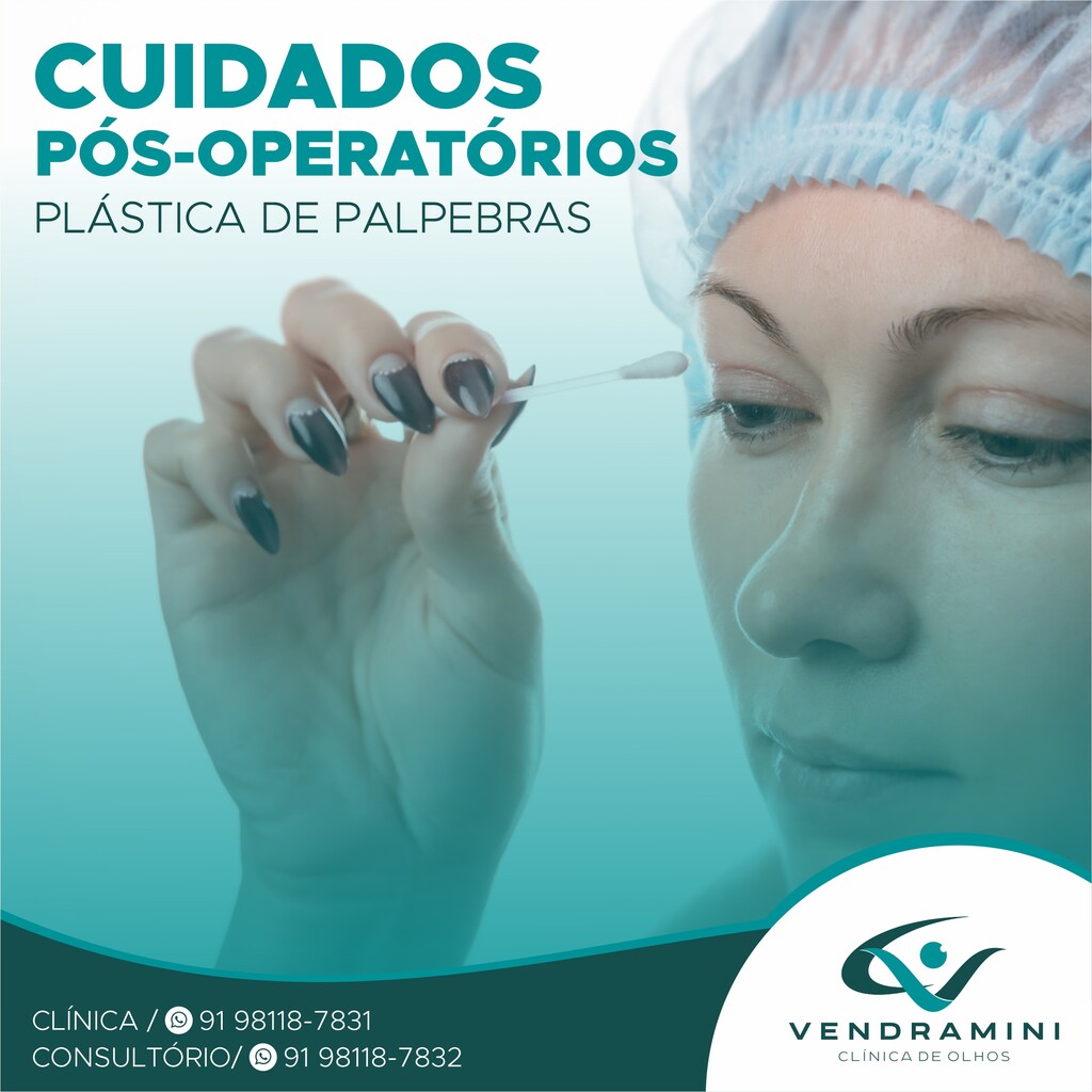 PLÁSTICA DE PÁLPEBRAS