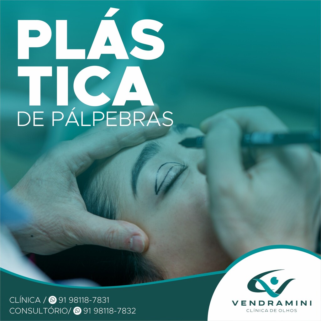 PLÁSTICA DE PÁLPEBRAS