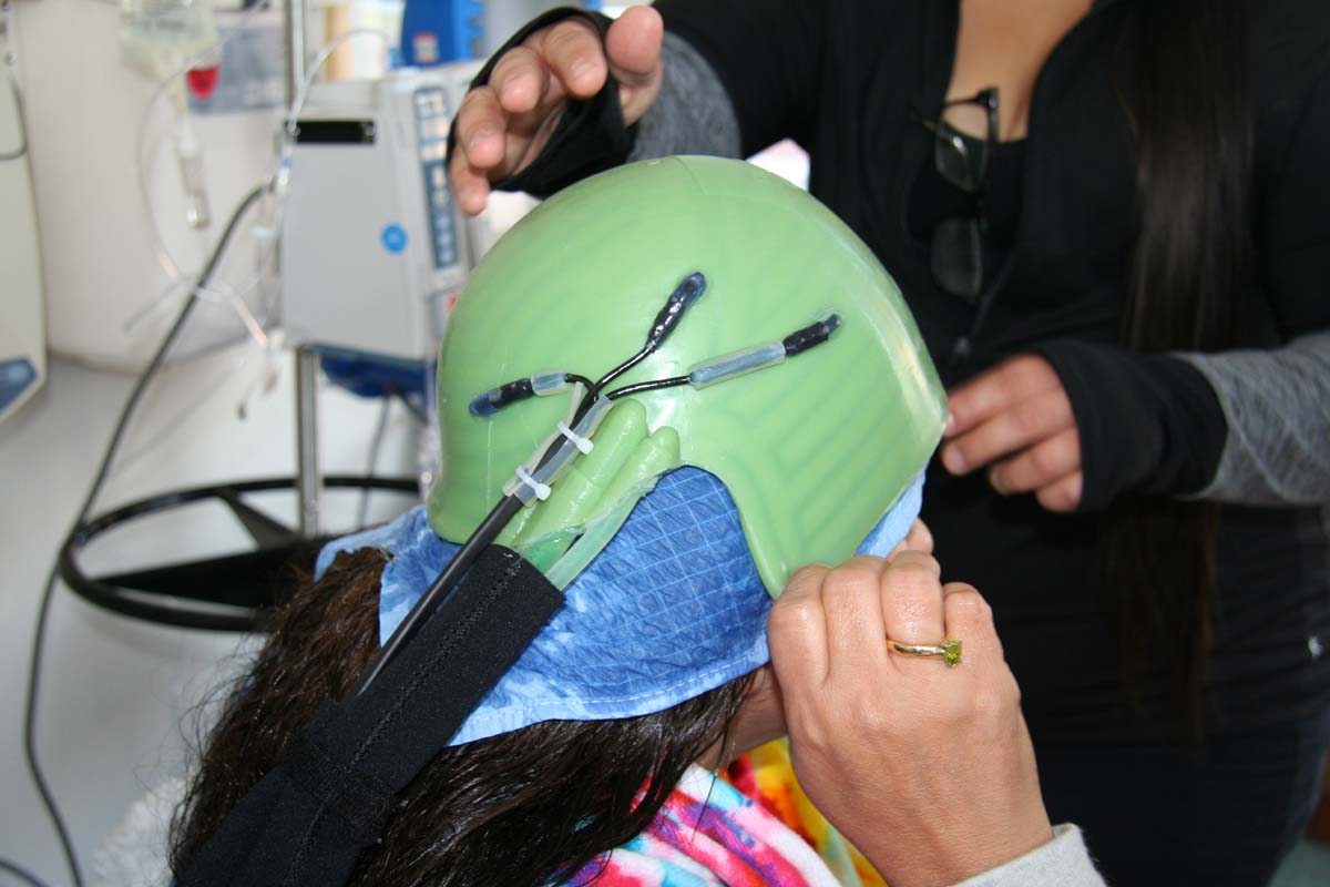 Studies Chemo Hair Loss Treatments Work Uchealth Today