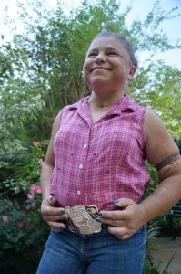 Sara Millard wears her championship belt buckle to a follow-up visit at UCHealth's University of Colorado Hospital.