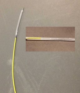the prototype