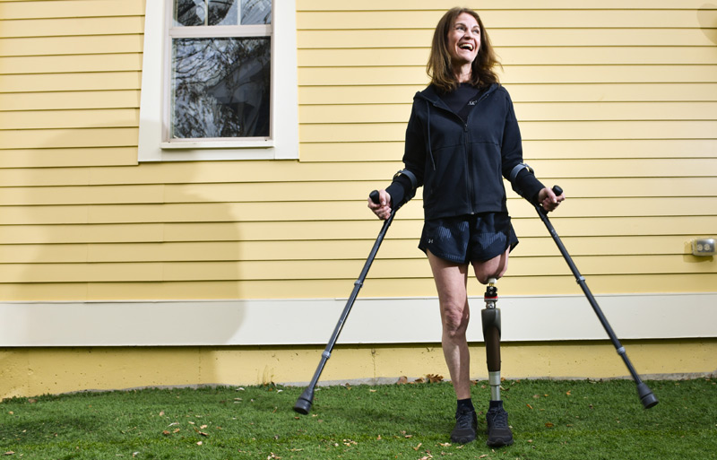 Woman, big smile on her face, uses crutches outside her home to help balance herself shortly after osseointegration surgery gave her new stability to her ambulated leg.