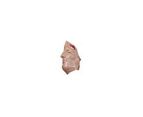 Casualty & Moulage Lacerated Forehead < simulaids #6725 