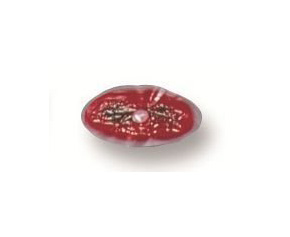 Casualty & Moulage Bladder Wound < simulaids #833 