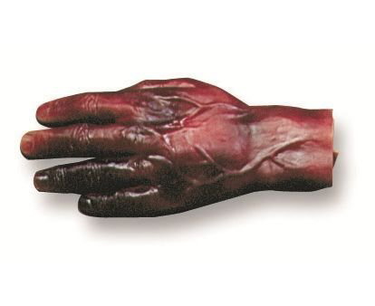 Burn Hand 2 & 3 Degree < simulaids #6799 