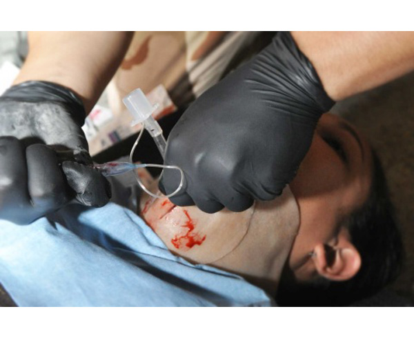 Cricothyrotomy Kit (1) < #TMK-CRICK 