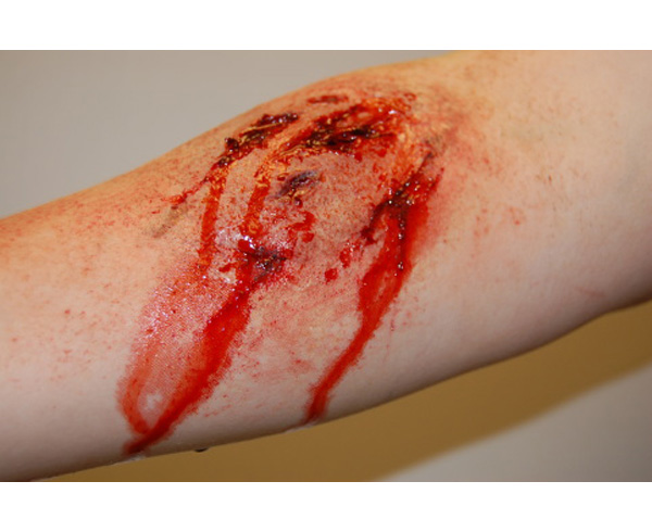 Basic Laceration (20) < #TMK-EPS-29-01-20 