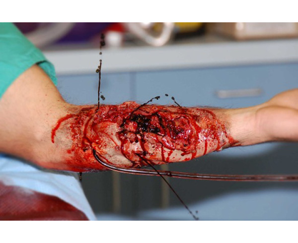 Bleeding Wounds Skills Trainer < #TMK-BWST 