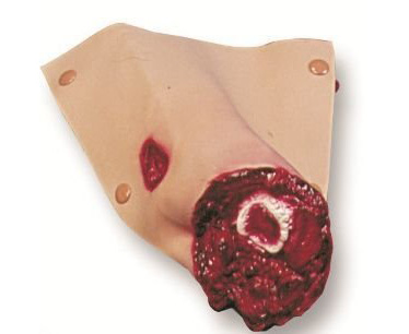 Casualty & Moulage Leg Amputation < simulaids #6760 
