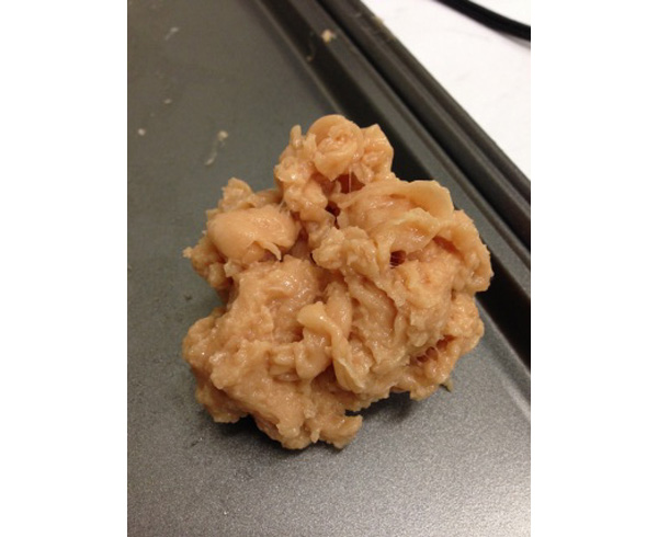 Ball of Adipose (Fatty) Tissue < #TMK-EPS-43 