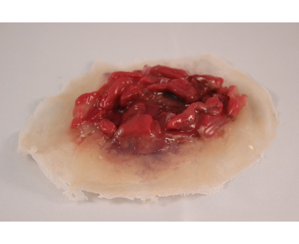 Arterial Laceration/Non-Dynamic (4) < #TMK-EPS-07-01-04-NT 